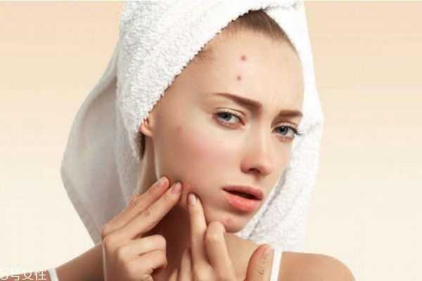 怎样治疗下巴痘痘