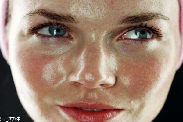 夏天脸上出油严重怎么办