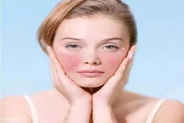 脸上出油长痘怎么调理