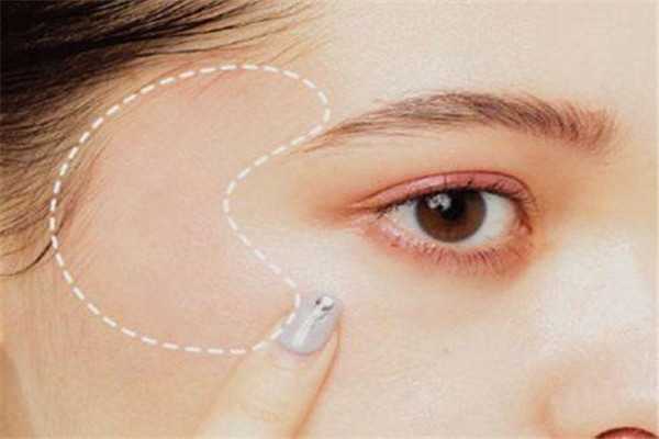 眼角皱纹多是什么原因