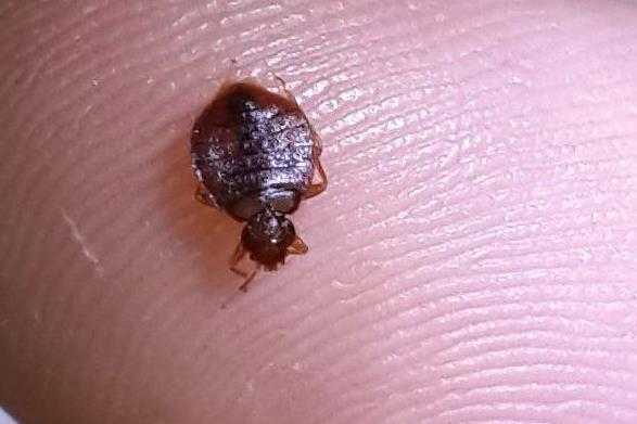 虱子的种类有哪些？头上生了虱子怎么去除？