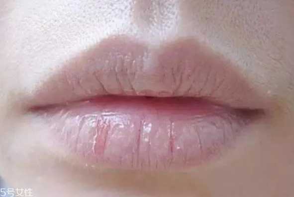 冬季如何护唇 护唇小妙招