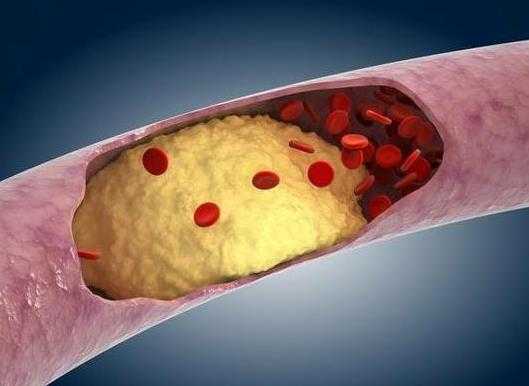 急x胰腺炎轻症有后遗症吗?急x胰腺炎重症有什么急救的方法 急x胰腺炎轻症有后遗症吗?急x胰腺炎重症有什么急救的方法