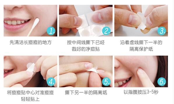 痘痘贴哪个牌子好？祛痘正确方法