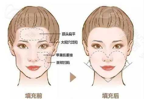 1718523964279304.jpg u=746168689,3755622116&fm=253&fmt=auto&app=138&f=JPEG.webp.jpg