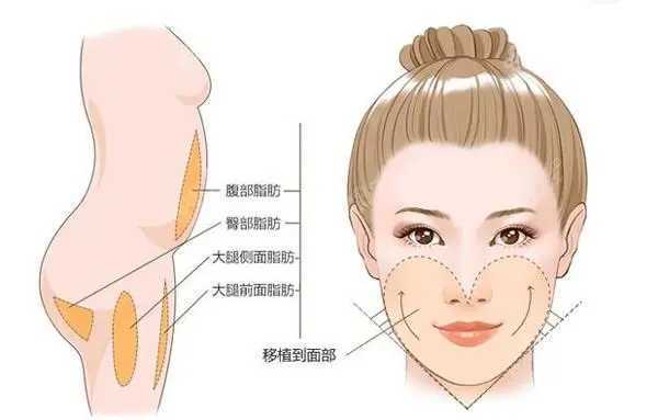 1718529161289771.jpg u=825453441,2826019542&fm=253&fmt=auto&app=138&f=JPEG.webp.jpg