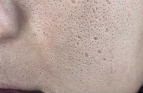 1718530840360620.jpg u=2570346453,418397031&fm=253&fmt=auto&app=120&f=JPEG.webp.jpg