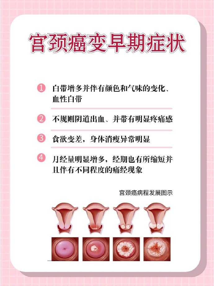 宫颈癌的早期症状表现有哪些 宫颈癌的早期症状表现有哪些