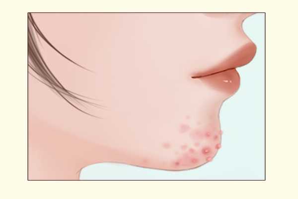 皮肤科医院哪家好?复旦大学附属华山医院排第一 皮肤科医院哪家好?复旦大学附属华山医院排第一