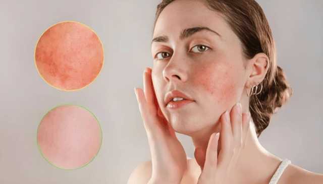 赫莲娜、兰蔻、赫徕、海蓝之谜七大祛皱面霜哪个好用