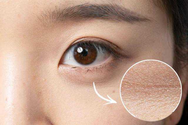 赫莲娜、兰蔻、赫徕、海蓝之谜七大祛皱面霜哪个好用