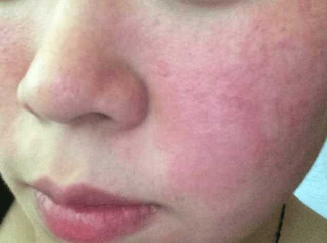 赫莲娜、兰蔻、赫徕、海蓝之谜七大祛皱面霜哪个好用