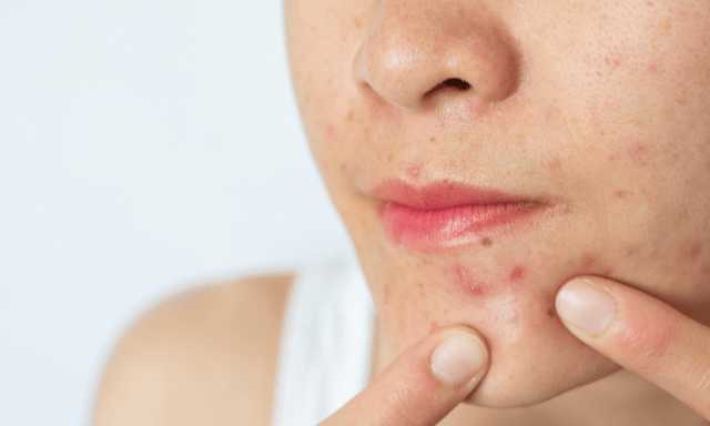 赫莲娜、兰蔻、赫徕、海蓝之谜七大祛皱面霜哪个好用