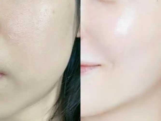 珀莱雅双抗用完脸变黑是怎么回事