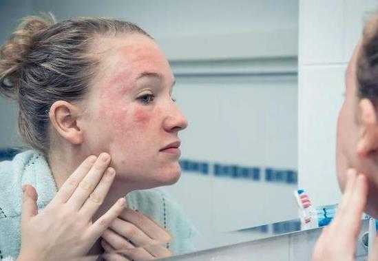 荨麻疹长了一次还会再长吗?得了荨麻疹喝酒后能吃药吗? 荨麻疹长了一次还会再长吗?得了荨麻疹喝酒后能吃药吗?