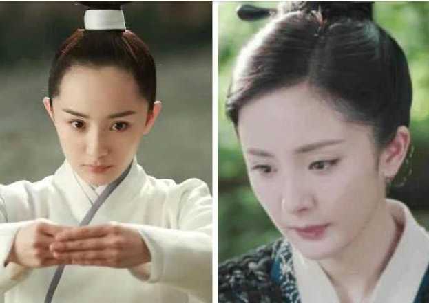 怎么解决发际线后移？发际线后移我们该如何挽救