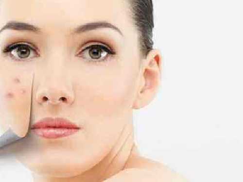 用什么去痘印最有效 用什么去痘印最好 用什么去痘印最有效 用什么去痘印最好