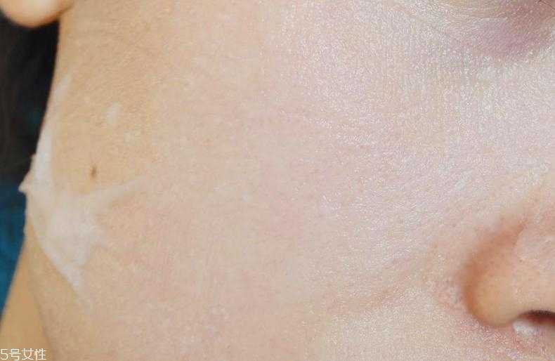 薇诺娜舒敏面膜免洗吗