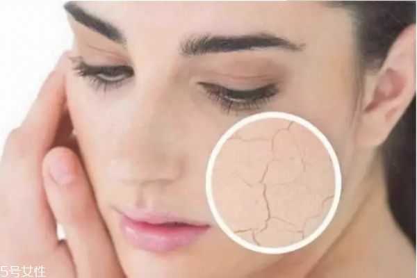 怎么选面膜 如何正确挑选面膜