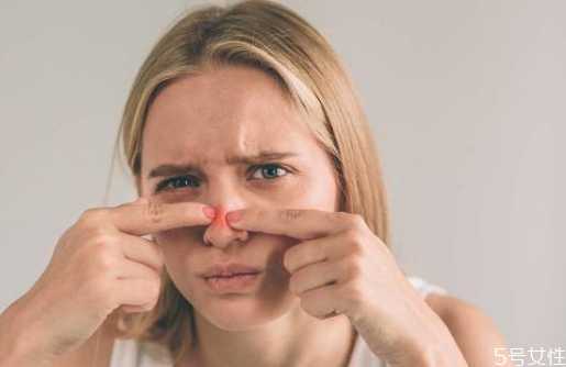 戴口罩过敏了怎么解决?医用口罩过敏怎么办 戴口罩过敏了怎么解决?医用口罩过敏怎么办