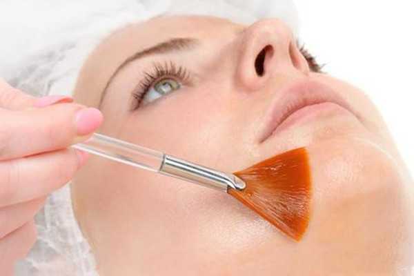 怎么度过水杨酸爆痘期?度过水杨酸爆痘期的方法 怎么度过水杨酸爆痘期?度过水杨酸爆痘期的方法