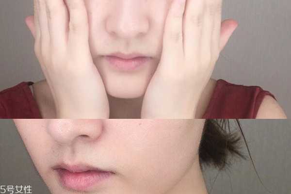 海蓝之谜面霜能祛痘吗