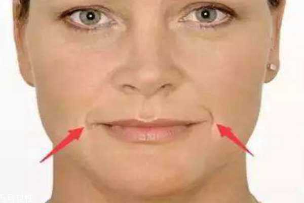 木偶纹怎么消除