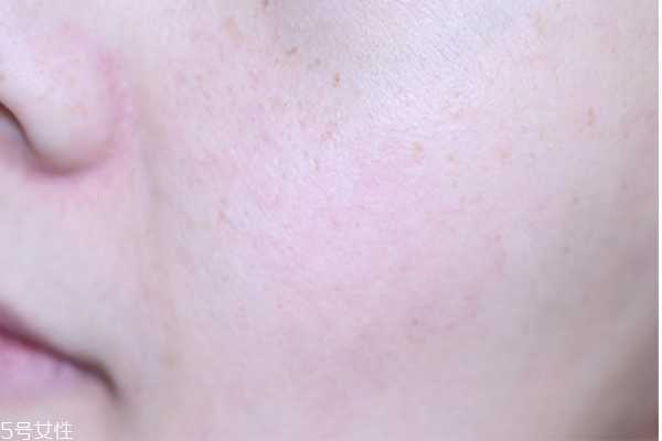 菲洛嘉十全大补面膜孕妇能用吗 mesomask面膜