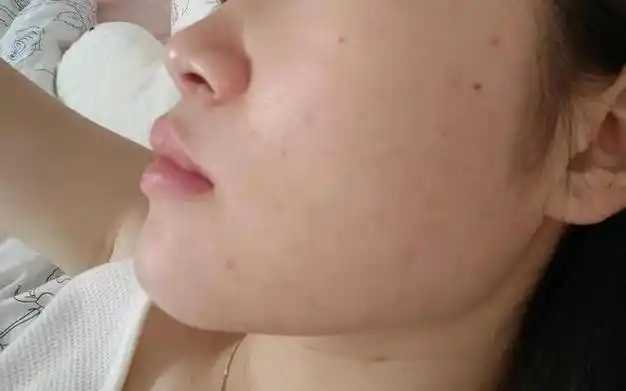 氨基酸洁面胶是什么 氨基酸洁面胶是什么