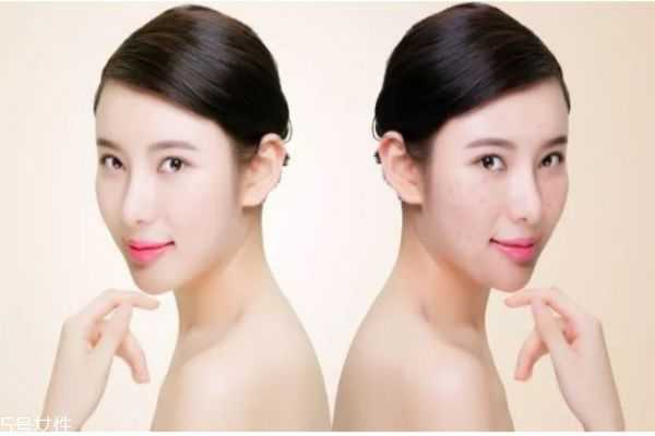 女人25岁后怎么保养皮肤