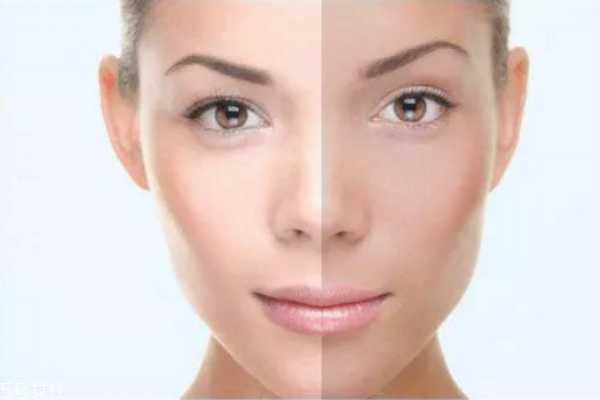 为什么皮肤越来越黄