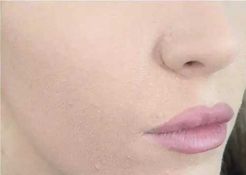 冬天皮肤干燥化妆卡粉解决小妙招 冬天皮肤干燥化妆卡粉解决小妙招