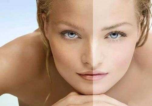 脸部皮肤暗黄怎么变白？脸部皮肤变得暗黄怎么解决