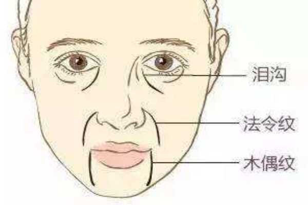 木偶纹怎么消除