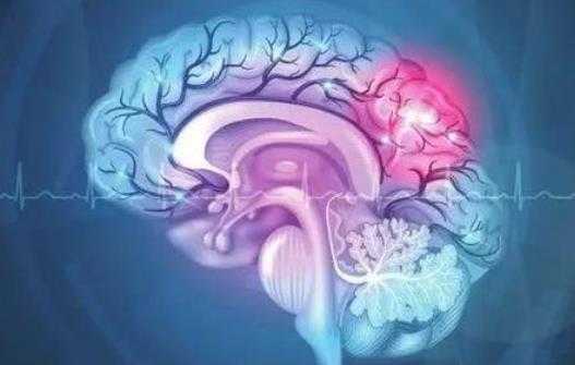 哪些疾病会引起脑供血不足？怎么预防脑供血不足？