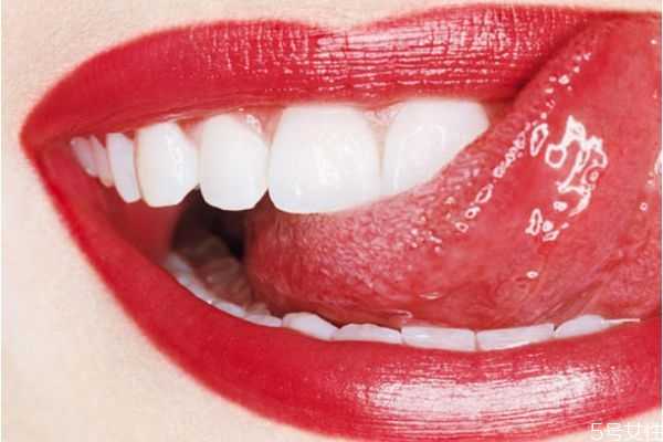 牙齿美白的小窍门有哪些？牙齿美白注意什么
