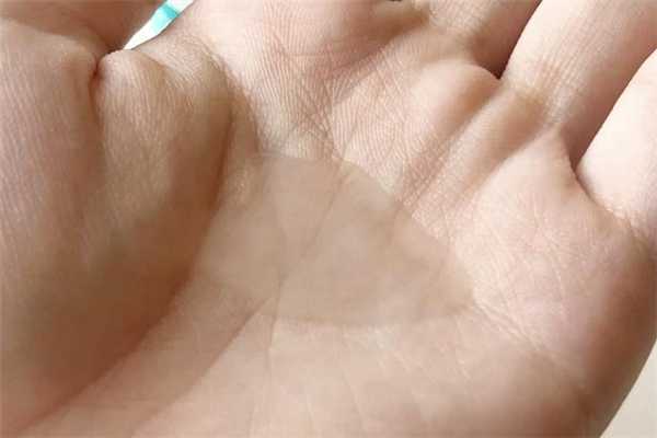 丽普司肽冻干粉可以祛痘印吗?丽普司肽修护版和祛痘版区别 丽普司肽冻干粉可以祛痘印吗?丽普司肽修护版和祛痘版区别