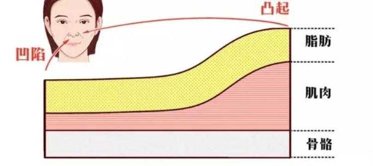 法令纹明显什么原因