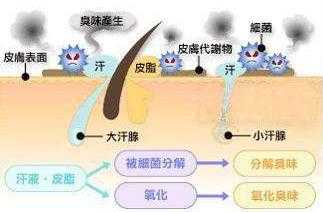 狐臭是什么原因引起的？体臭和狐臭的区别