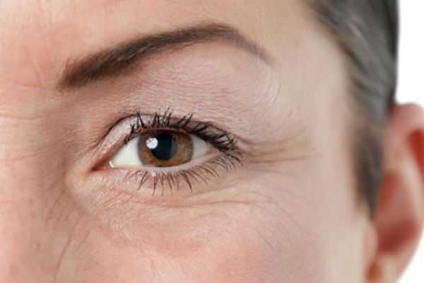眼睛细纹怎么去掉？去掉眼睛细纹的方法