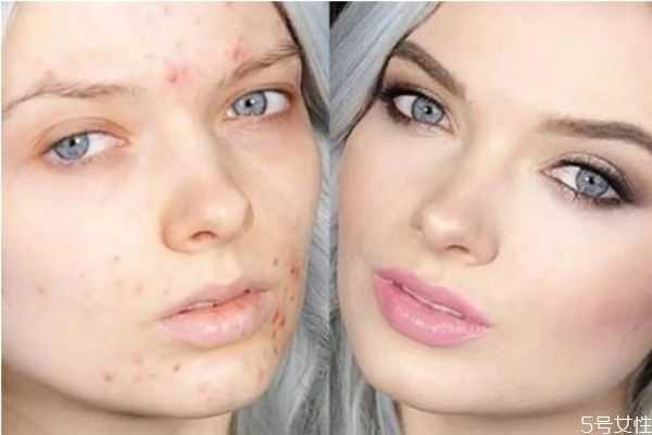 化妆会起痘痘吗?长痘痘到底能不能化妆 化妆会起痘痘吗?长痘痘到底能不能化妆