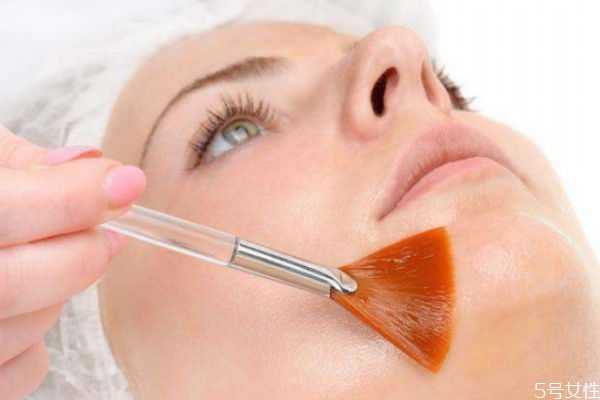 刷酸为什么爆痘?刷酸为什么要防晒 刷酸为什么爆痘?刷酸为什么要防晒