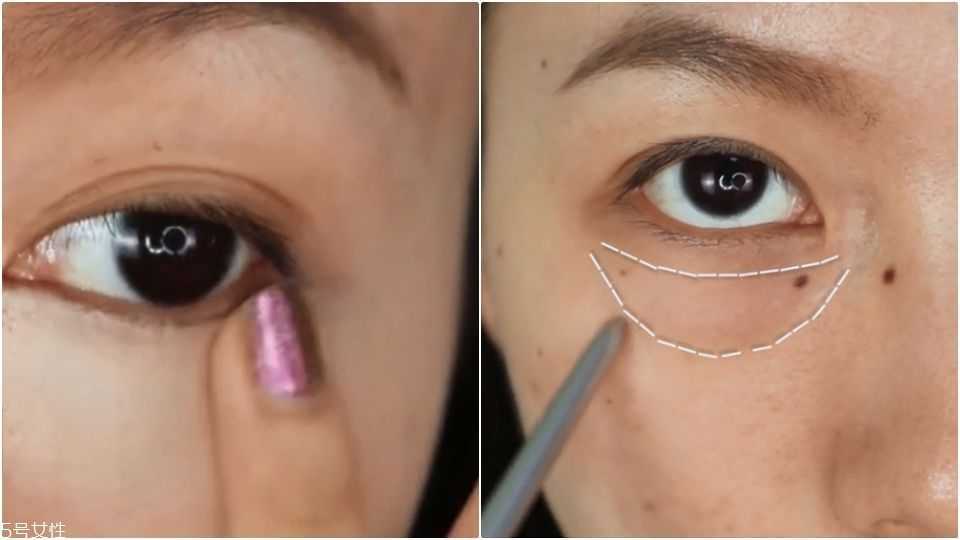 重度泪沟怎么遮瑕
