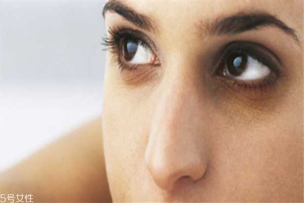 黑眼圈和眼袋有什么区别 黑眼圈和眼袋的区别