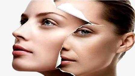 脸部松弛下垂如何改善?脸部为何会松弛 脸部松弛下垂如何改善?脸部为何会松弛