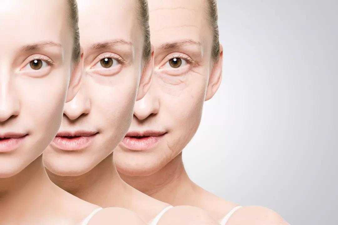 脸部松弛下垂如何改善?脸部为何会松弛 脸部松弛下垂如何改善?脸部为何会松弛