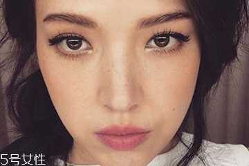 雀斑是什么原因引起的