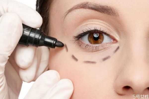 面部刮痧能去眼袋吗？经常刮眼眶能去眼袋吗