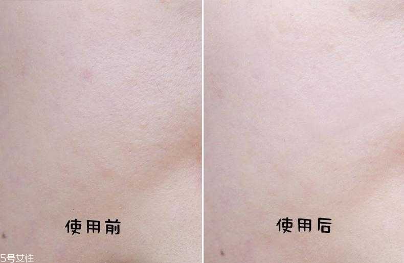 薇诺娜舒敏面膜免洗吗