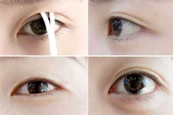 双眼皮定型霜管用吗？双眼皮定型霜和双眼皮贴哪个好
